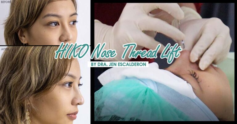 HIKO Nose Lift: How it feels like, where to get it, and everything you ...